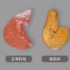 胆汁其实由人体的哪一个器官分泌的? A:胆囊 B:肝脏